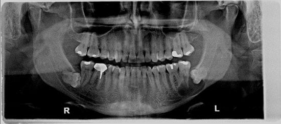 Digital X-Ray