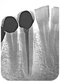 Digital Dental XRay Fort Collins CO